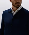 State of Art Vest Buttons