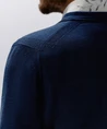 State of Art Vest Buttons